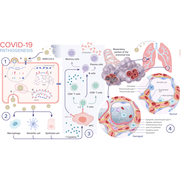 Latest Insights on the Diagnostic Approaches and Treatment Strategies of Epidemiology, Pathogenesis, Diagnosis and Possible Treatment of COVID–19 Infection