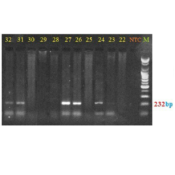 Detection of bla OXA-48 and bla IMP Resistance Genes in Escherichia coli and Klebsiellapneumoniae Isolated from Children with Urinary Tract Infections