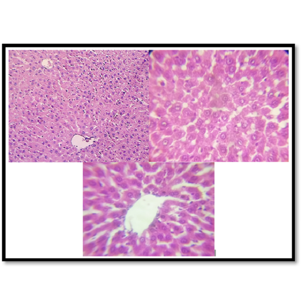 Histological Changes of Liver Tissue Triggered by Antibiotic Drug Azithromycin and the Ameliorative Effects of Garlic in Male Albino Rats